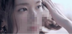 宁波艺星美杜莎美眼术，让眼睛增大，变成一种自信