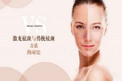 激光祛斑与传统祛斑方法的对比