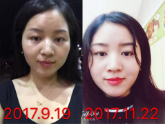  遇见禅吻集—人生若只如初见