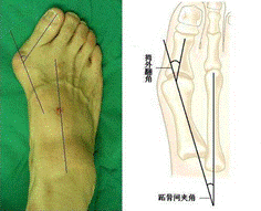 QQ截图20180326161942