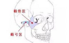 颧骨高能做线雕吗-隋冰