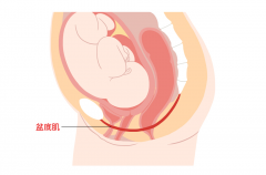 产后阴道松弛怎么办？有什么方法能紧致起来？